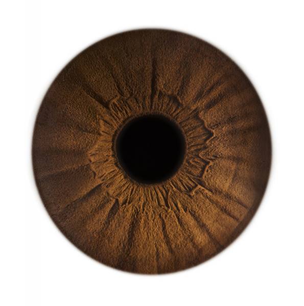 Photograph Jonathan Knowles Vision Express 1 on One Eyeland